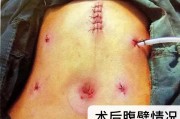  黄蜂三球接受左腕手术根治  